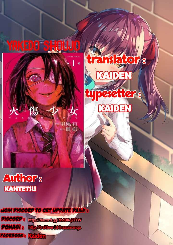 Baca Yakedo Shoujo Chapter 4  - GudangKomik